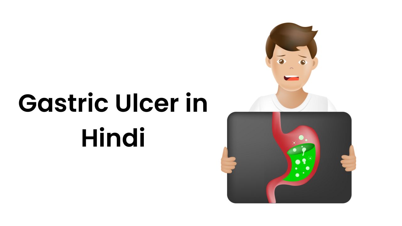 Gastric Ulcer in Hindi