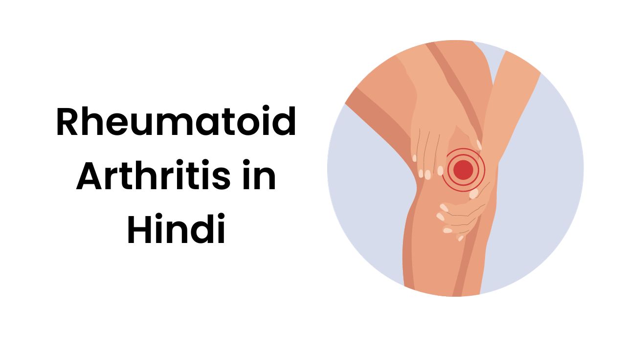 Rheumatoid Arthritis in Hindi