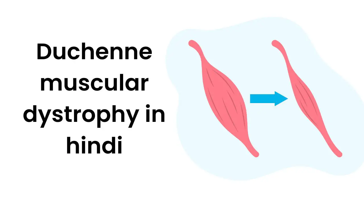 Duchenne muscular dystrophy in hindi