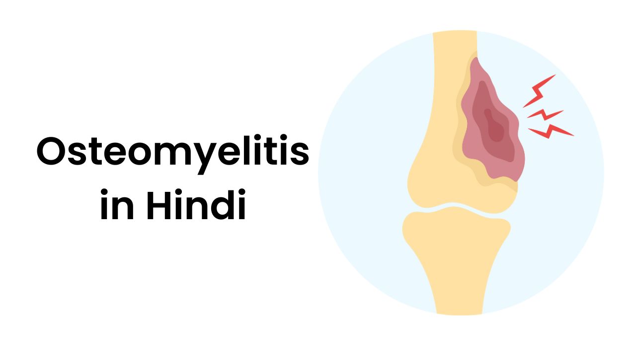 Osteomyelitis in Hindi