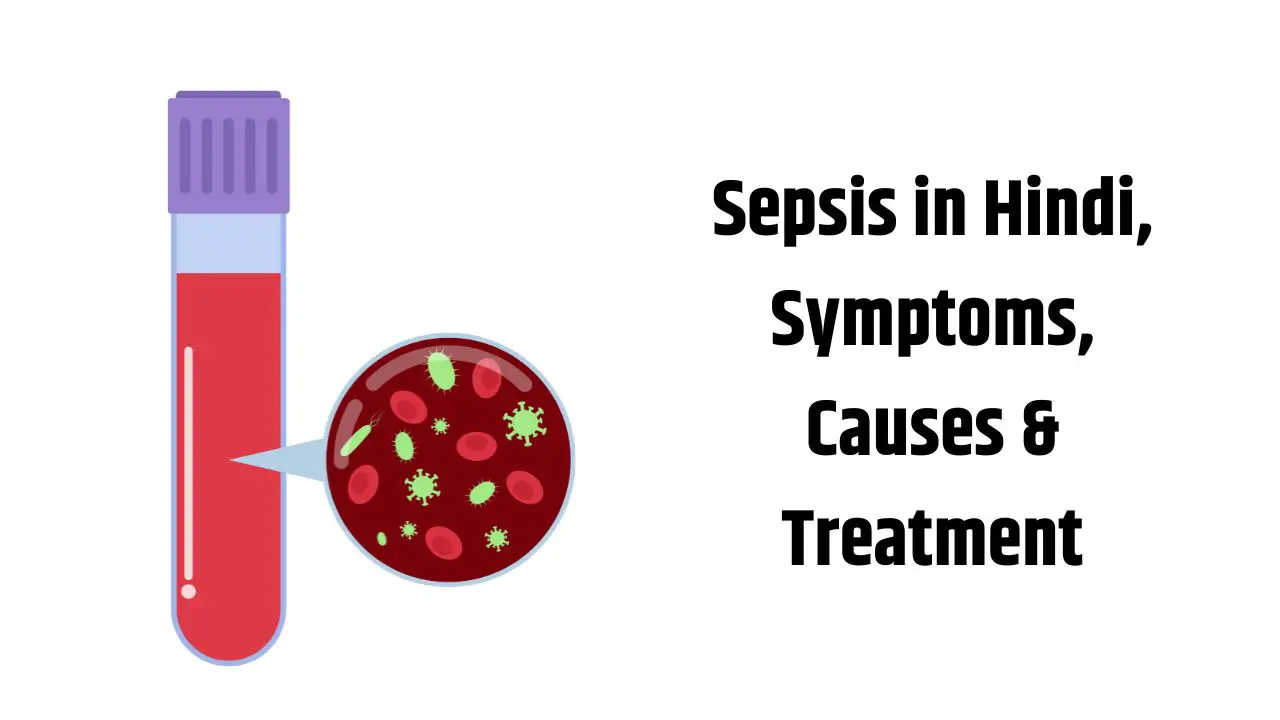 Sepsis in Hindi, Symptoms, Causes & Treatment